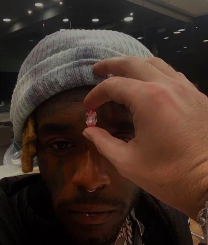 Lil Uzi Vert Says He’ll Be Getting A Diamond Implanted On His Forehead