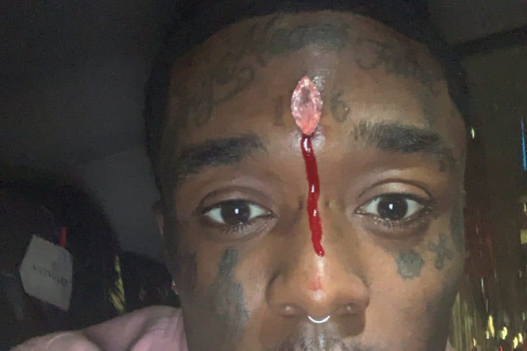 Lil Uzi Vert Says Fans Tore $24M Diamond Off His Forehead