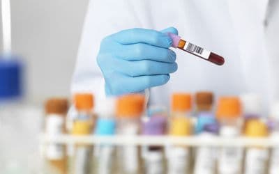 Life Changing Drug To Be Released By NHS For People With Sickle Cell Disease